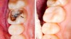 3 cách tự nhiên đánh bật các lỗ sâu răng cực hiệu quả</span>